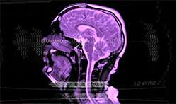 ressonanciamagnetica